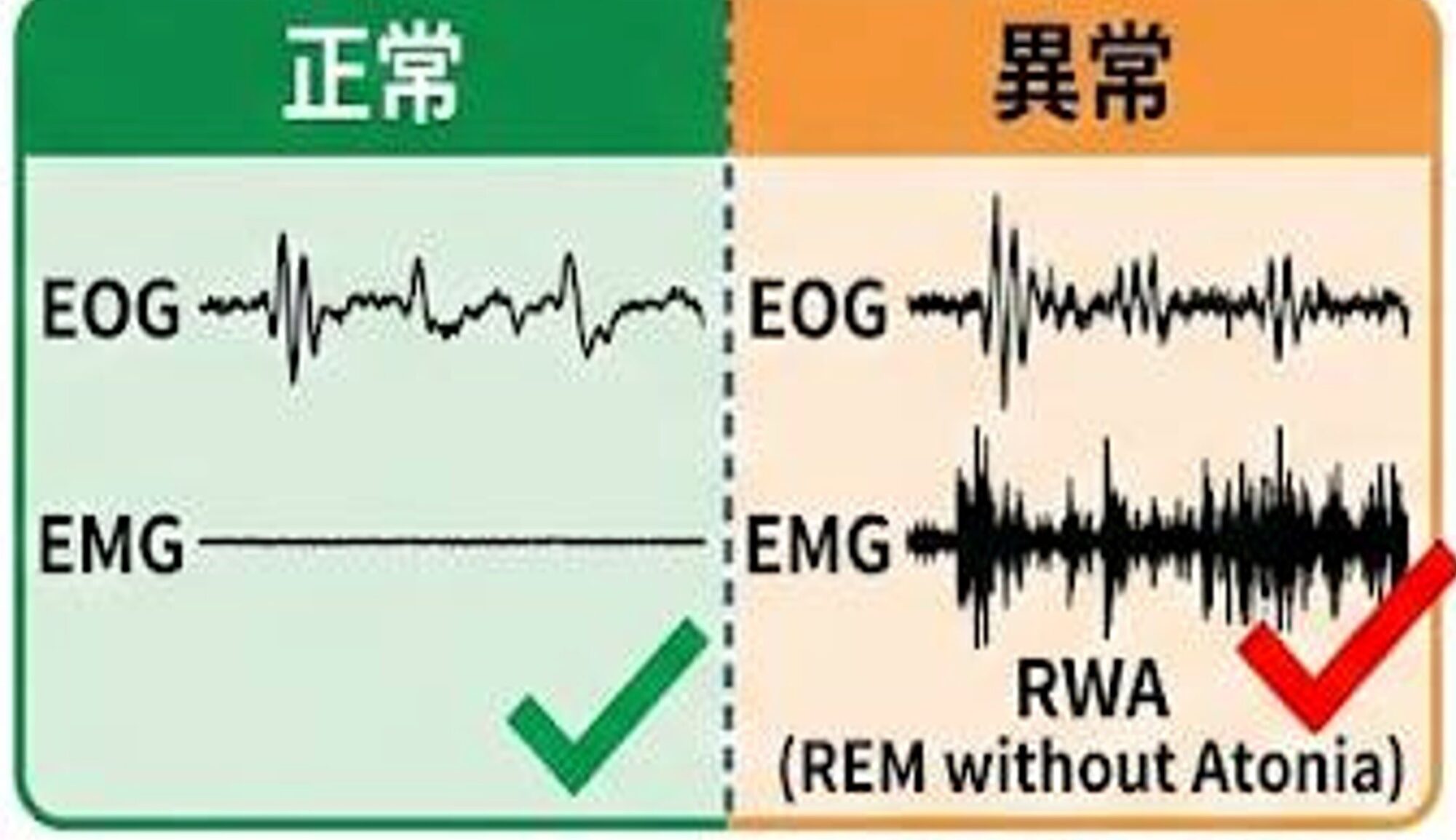 RWA