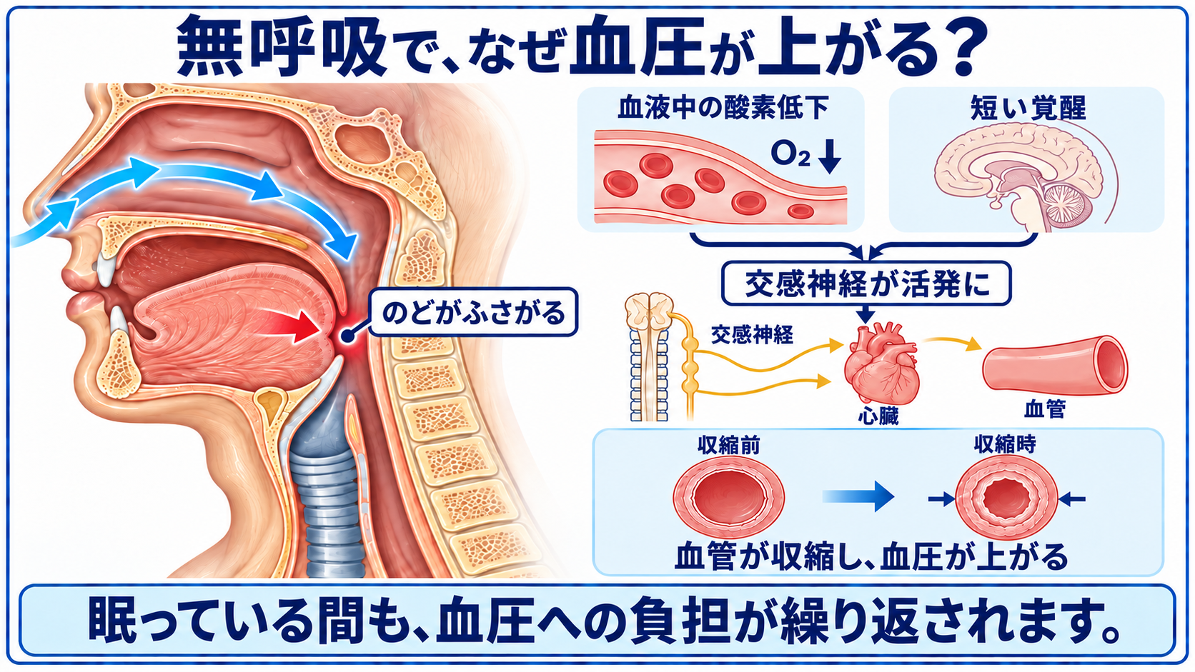無呼吸による酸素低下や短い覚醒から交感神経が刺激され、血圧が上がる経路