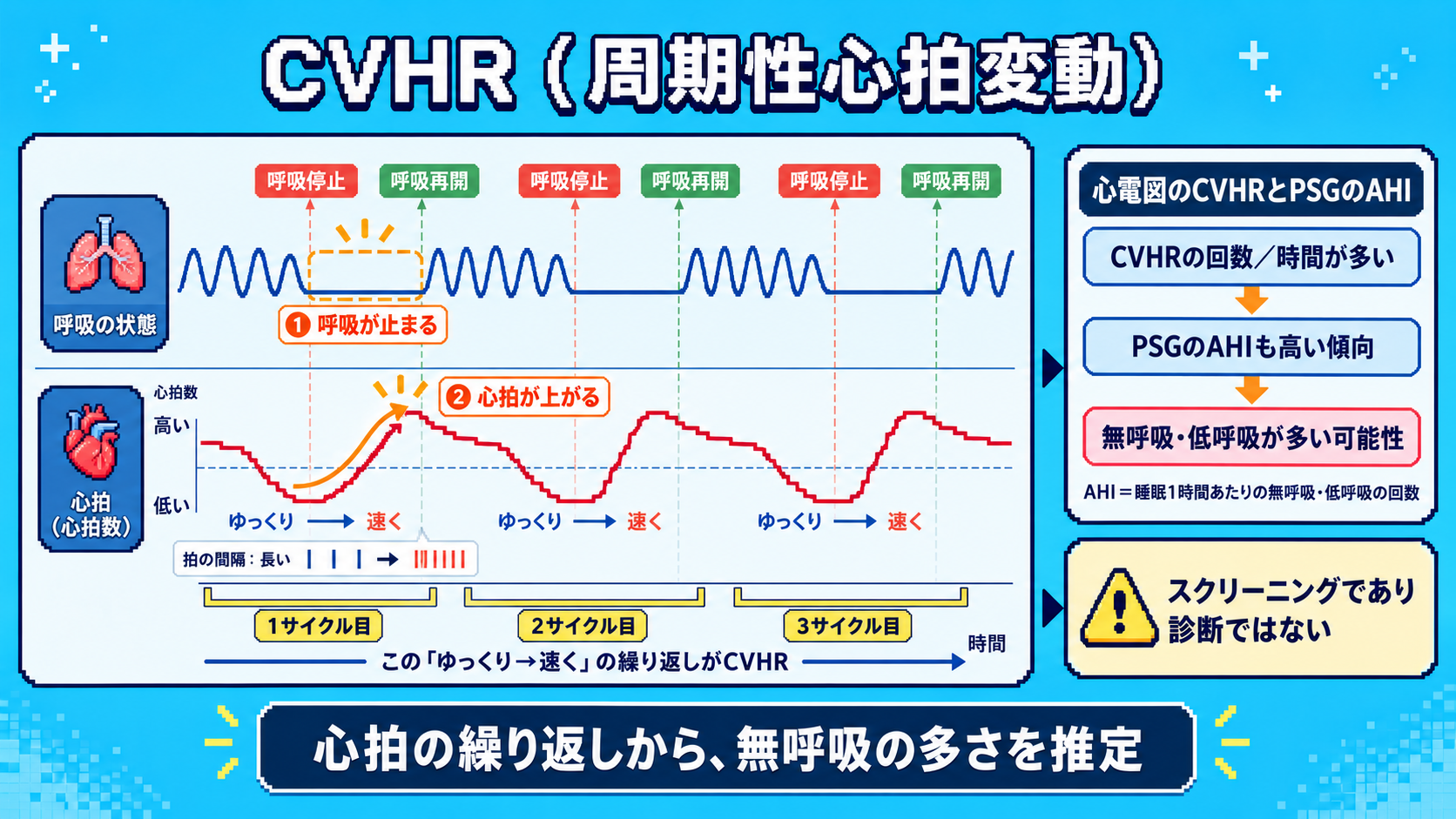無呼吸に伴う心拍の増減が繰り返されるCVHR。心電図の解析で無呼吸を疑う手がかりになる。